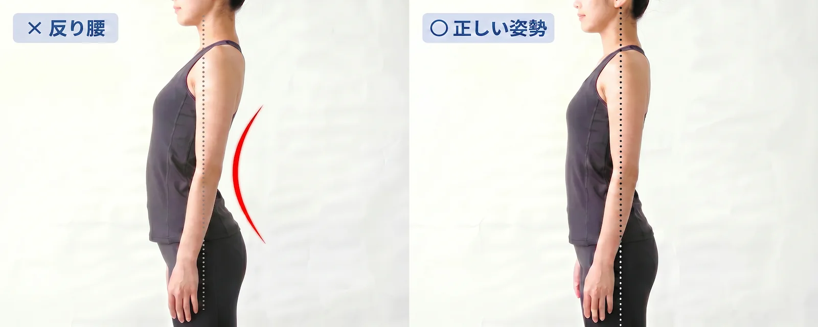 反り腰と正常な姿勢の横から見た比較イメージ